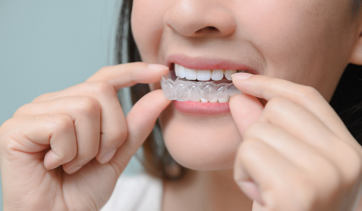 CASE STUDY: Building a US sales team for a startup dental aligner manufacturer