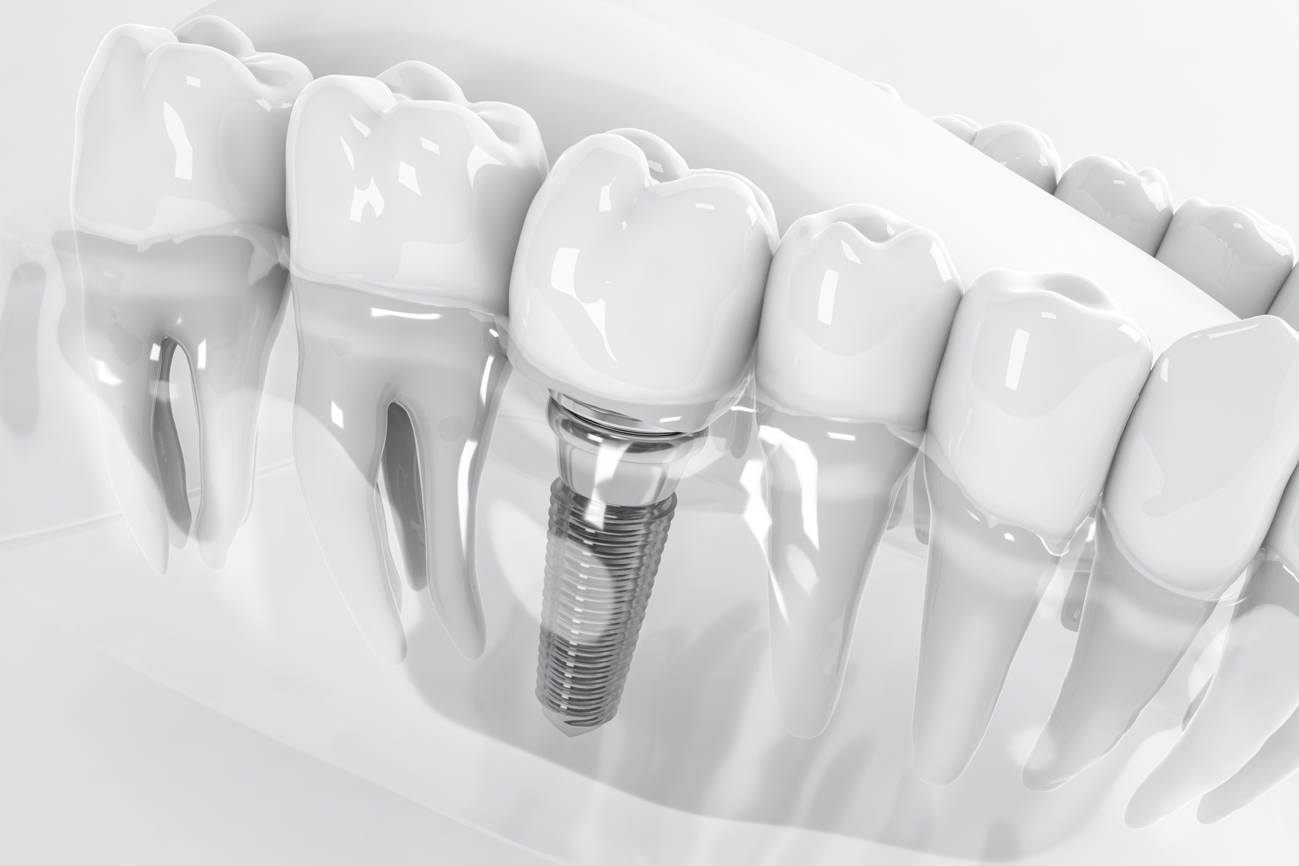 Spotlight On 3D Printing: An Interview with SprintRay’s Mike Baker