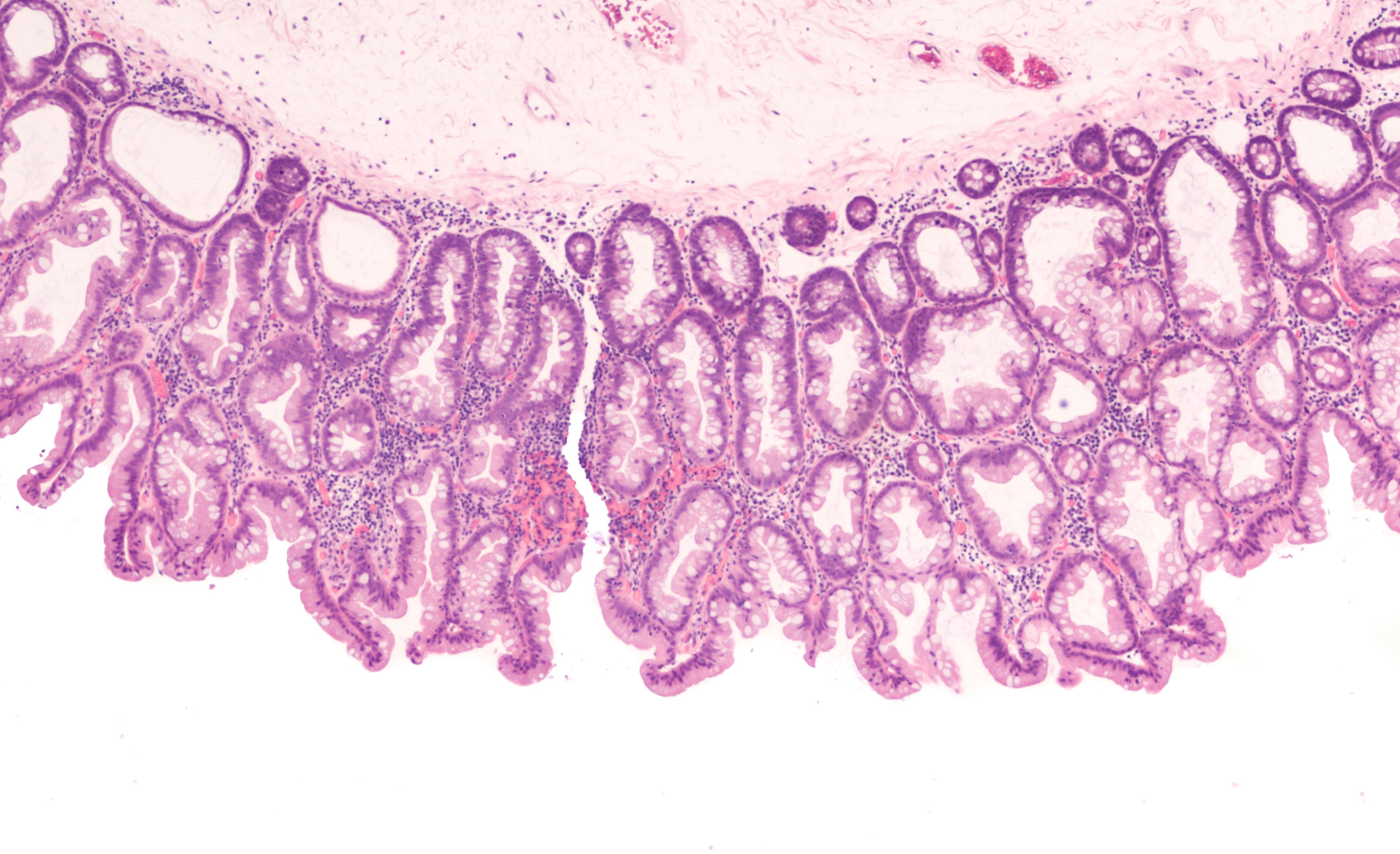 AI-Powered Solutions for Colorectal Cancer Detection