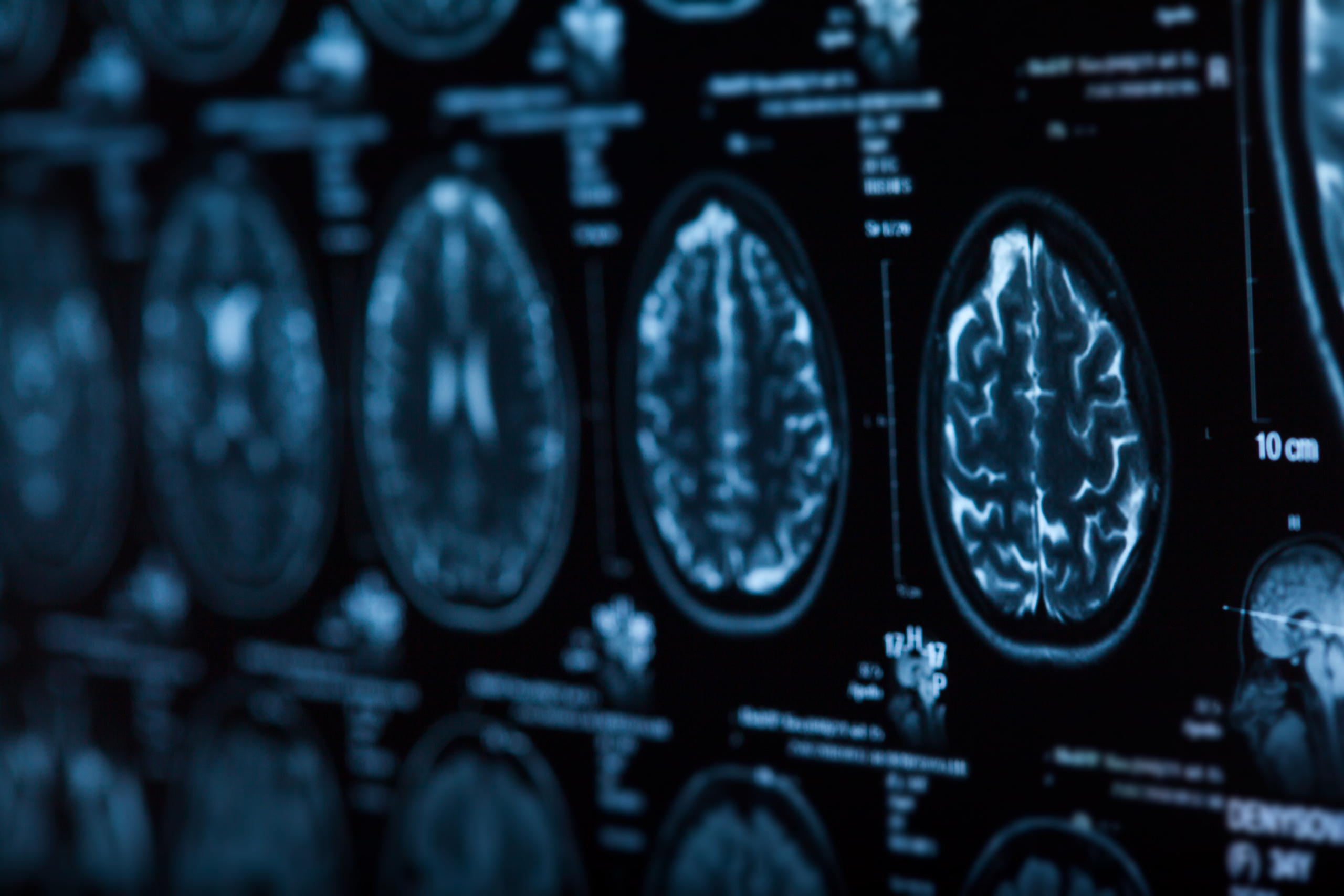 Spotlight On Neuronic: An Interview with Co-Founder Liam Pingree