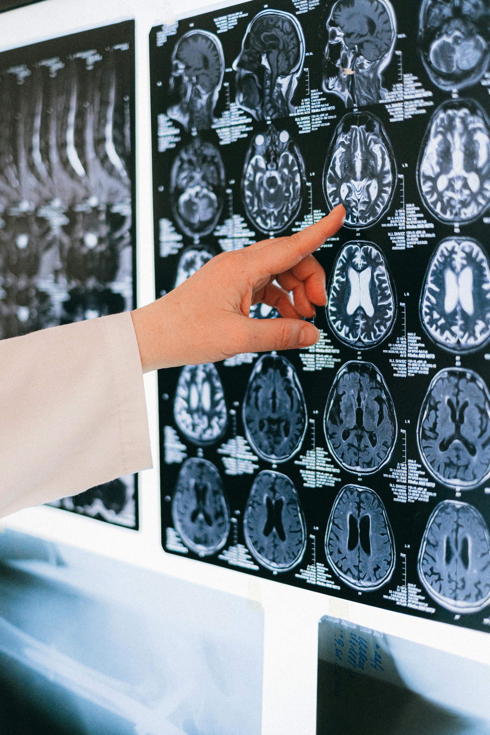 Pioneers in Neurotechnology: The Fastest-Growing Startups to Watch